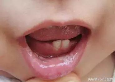 一招解决宝宝不爱喝奶,别再错怪孩子了