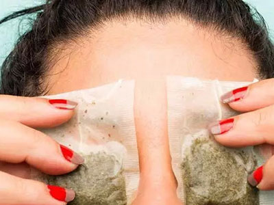 怎样去除眼角皱纹大家都咋做的,脸上眼角皱纹怎么去除男生