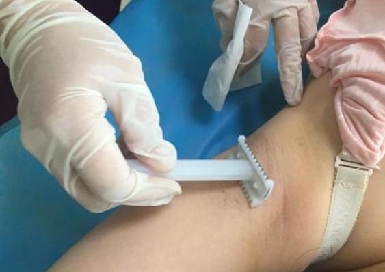 生娃前刮毛叫什么,生孩子必须要剔除体毛吗