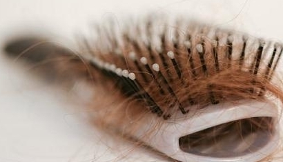 为什么现在的人脱发掉发严重,为什么年轻人老是掉头发