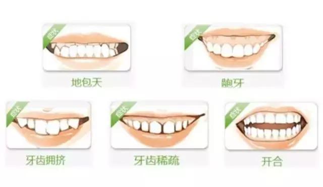 前面牙缝大漏财真的吗,牙缝大是有福气还是漏财