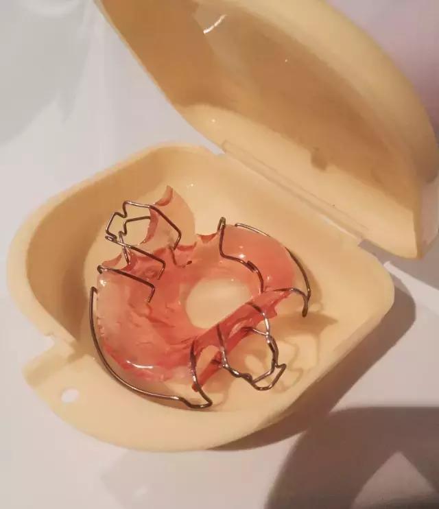 要不要戴牙套做牙冠,到底要不要戴全瓷牙套