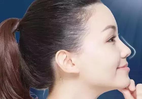 想打玻尿酸有副作用吗,想打玻尿酸怎么打