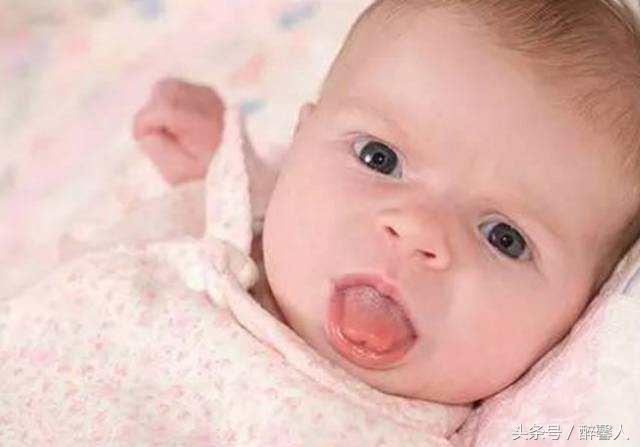 宝宝舌苔两边发白中间发红,宝宝舌苔有两块缺陷