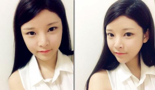 婴儿肥减肥能瘦下来吗,婴儿肥能通过运动瘦下来吗