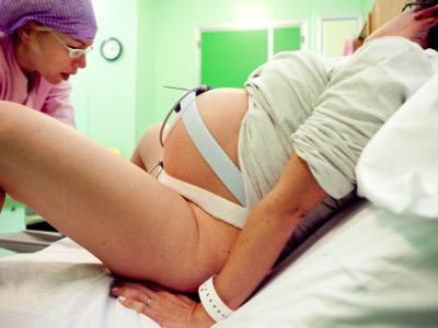 顺产侧切有什么影响,顺产侧切对夫妻有什么影响