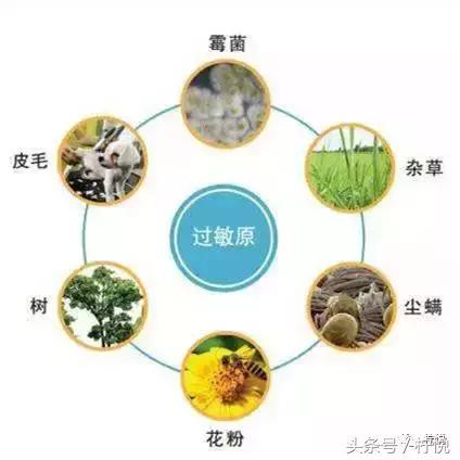 舒淇经常过敏,舒淇过敏好了吗