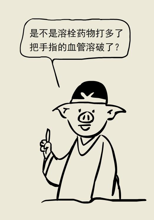 放血拔罐能治脑出血病人吗,脑出血后昏迷扎十指放血有效吗