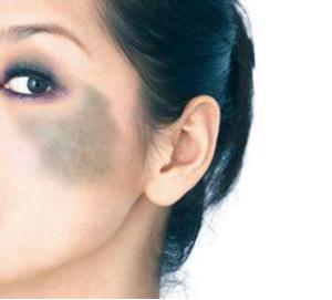 胎记算命揭秘,胎记算命真的可信吗女生