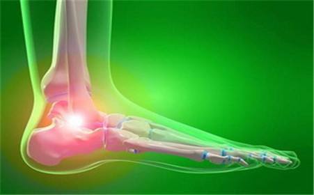 很费鞋的1种病，跑、跳、走、站都特累，预防很重要