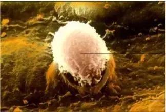 肿瘤患者发烧为什么不能用退烧药,身体有肿瘤或癌症一定会发烧吗