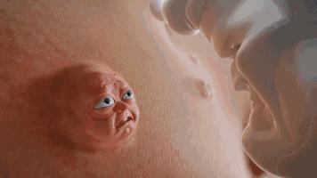 挤痘痘留下的痘印大概多久会好,挤痘留下的红色痘印怎么祛除