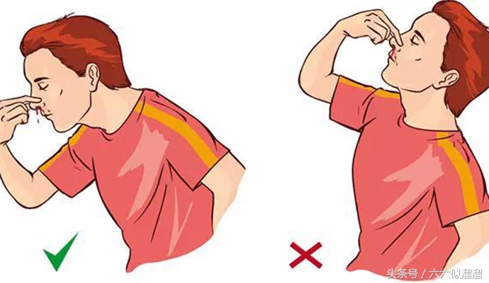 在没有绷带急救时哪些是错误的,10个常见的急救技巧90%的人做错了
