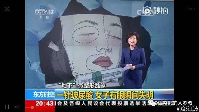 罗叔:10问玻尿酸(建议收藏)