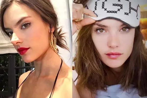 毛孔粗大痘印暗沉怎么修复,毛孔痘印怎么消除最快