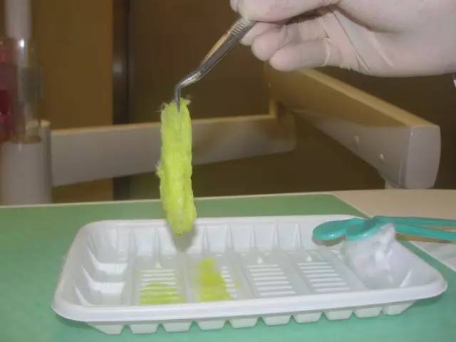 嘴唇上火起皮最快最有效的方法,上火引起的嘴唇干裂起皮怎么治