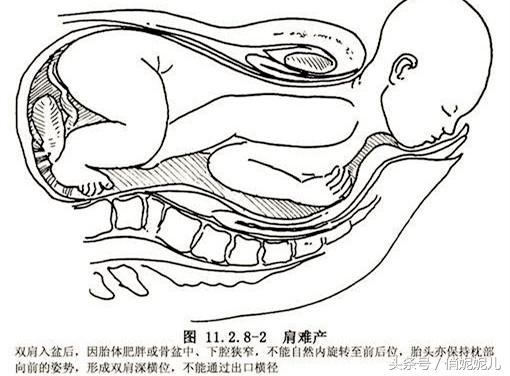 怀孕要怎么做导致流产,怀孕期在家都有啥事情做