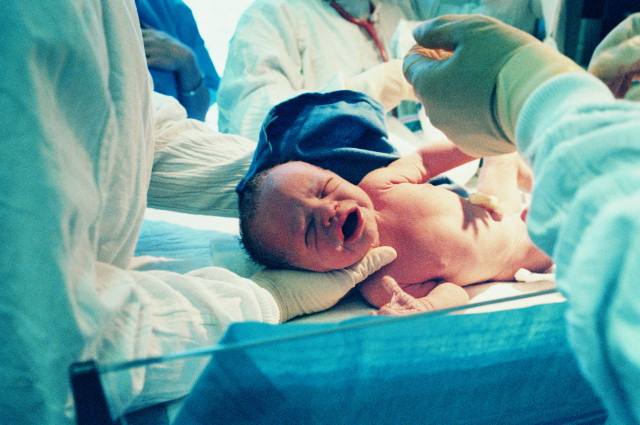 分娩时为什么要“侧切”？99%的准妈妈不知道其中的关键！