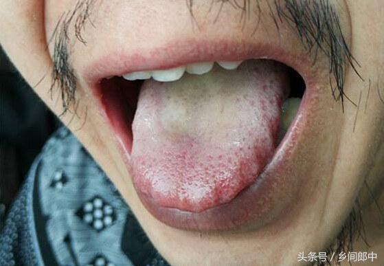 脾虚气虚阴虚有什么症状,气虚阴虚血虚脾虚辨证