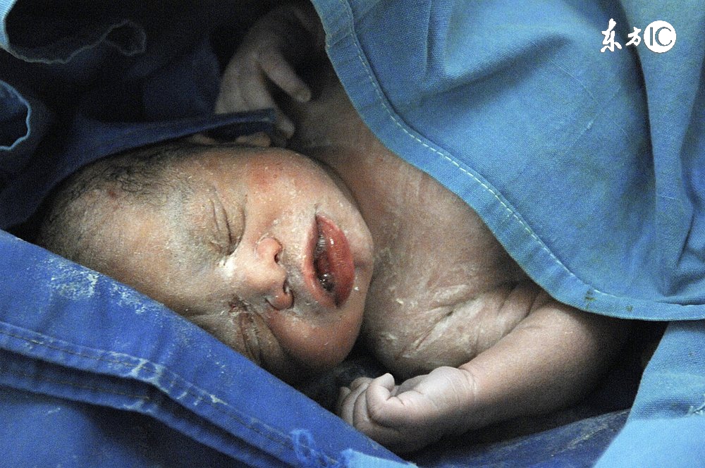 产后专题丨怀胎十月我们的肚子到底有多脏？以下4招轻松洗净身体