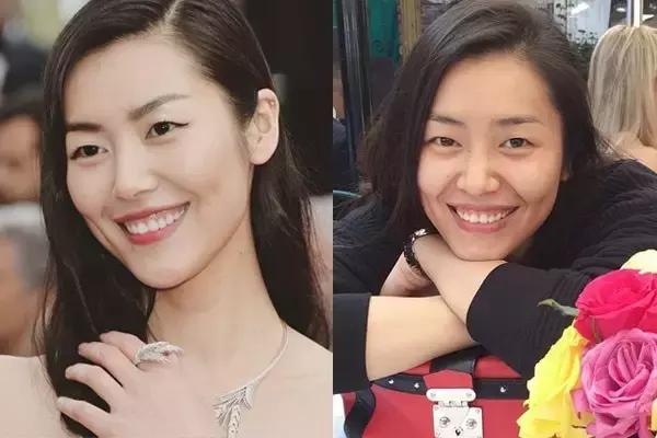 毛孔粗大痘印暗沉怎么修复,毛孔痘印怎么消除最快