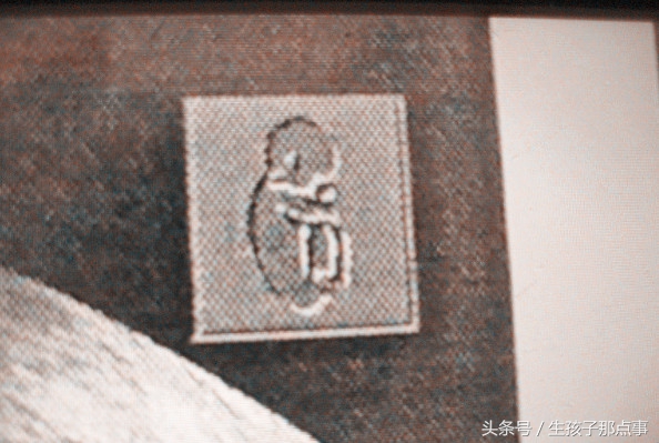 专家分享b超单的奥秘,b超单上的100个小秘密