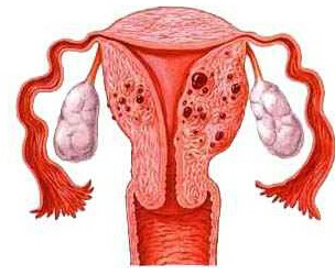 忽悠女人多年的4种病，听上去挺吓人的，其实不一定要治