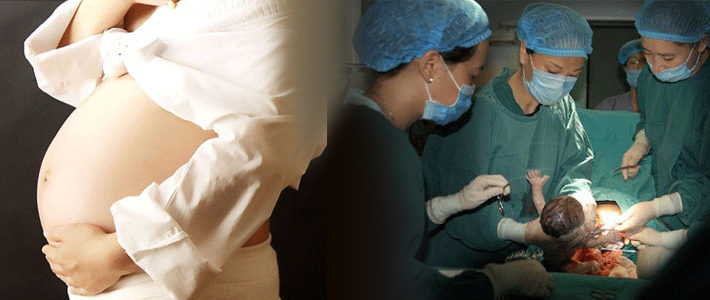 月子营养食谱剖腹产下奶,剖宫产月子餐食谱表格有区别吗