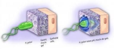 幽门螺杆菌不能根除怎么办,幽门螺杆菌根治不了怎么办