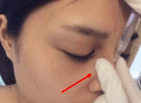 鐜诲翱閰稿埌搴曡兘涓嶈兘澶氭墦,鎵撶幓灏块吀鍒板簳鏈夊鐥涜嫤