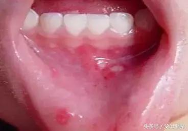 一招解决宝宝不爱喝奶,别再错怪孩子了