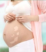 白癜风女生怀孕,吃了治疗白癜风的药怀孕了能要吗