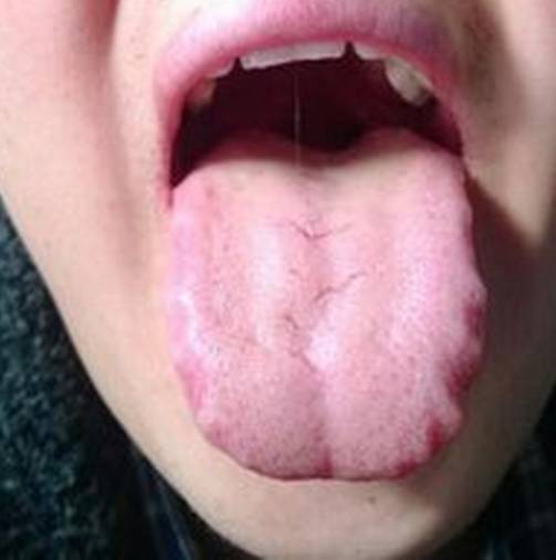 体内湿气危害太大,有多少个雷区被你踩到了