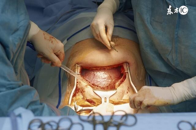 当分娩“内检”遇上男医生！竟有99%的产妇都说求之不得！