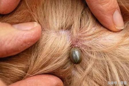 踏青怎么防止蜱虫,踏青被蜱虫咬