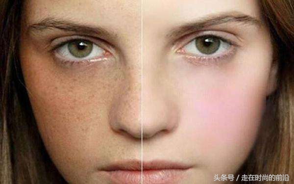 妊娠斑其实没有那么顽固，照我说的做就把它搞定