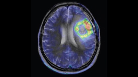放射诊断科普,放射影像科普知识大全