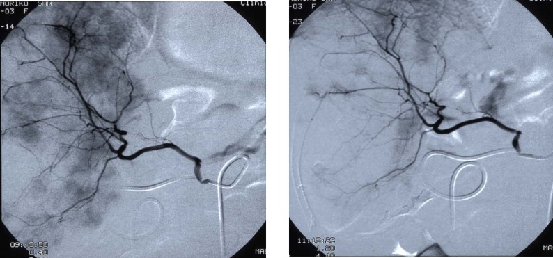 放射诊断科普,放射影像科普知识大全