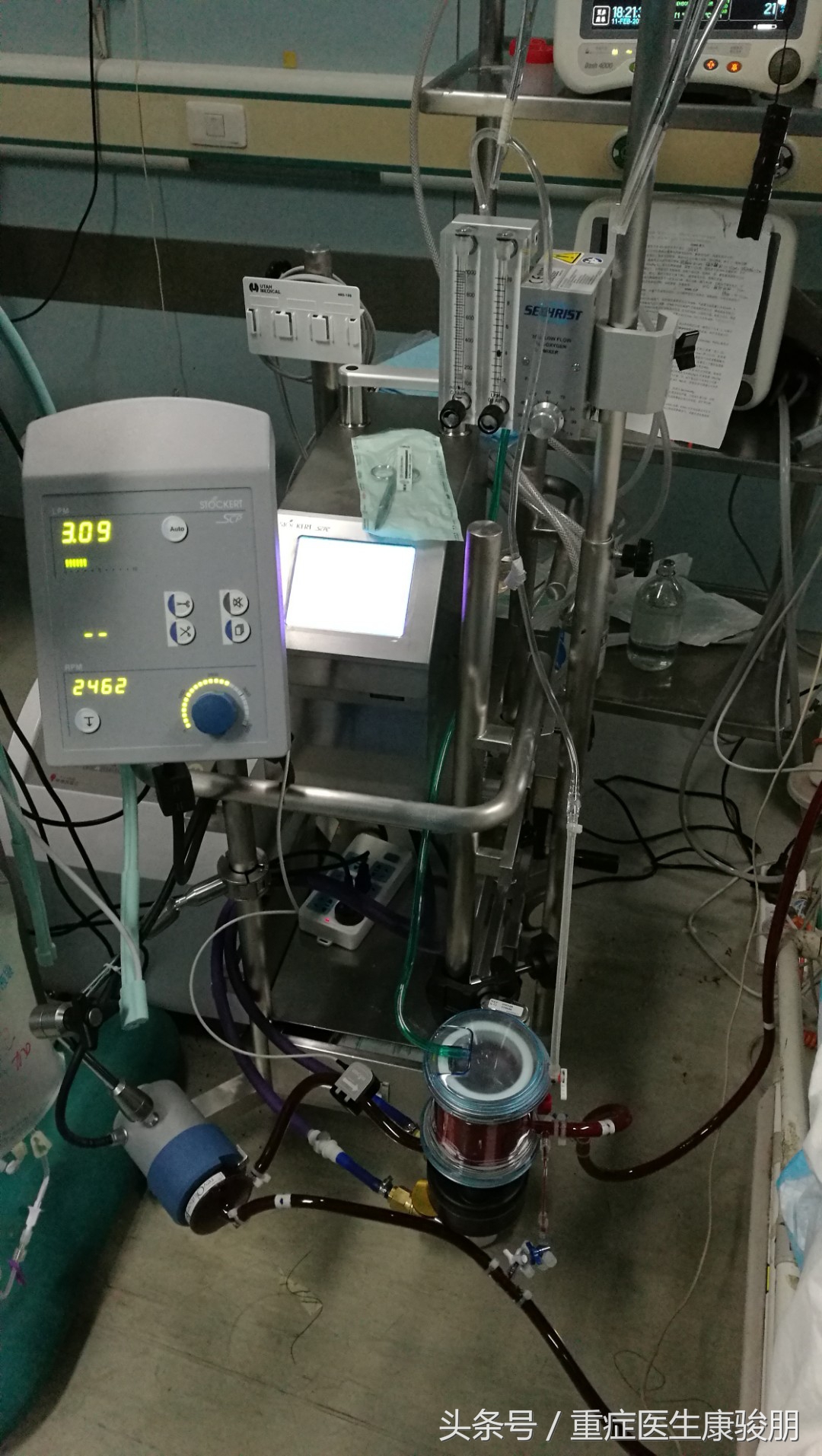 为什么用ecmo有并发症,ecmo相当于哪种急救方法