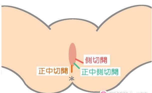 顺产撕裂缝合打麻药吗,顺产有轻微撕裂医生说不用缝合