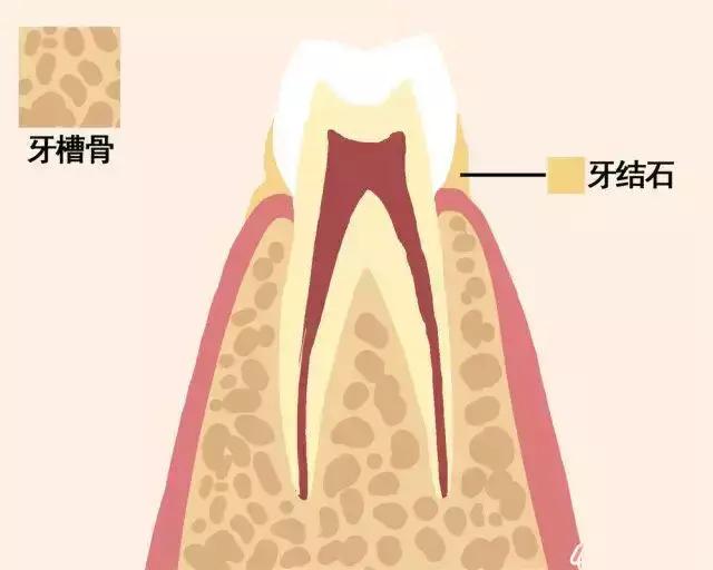 牙齿脱落的顺序图,一张动图告诉你