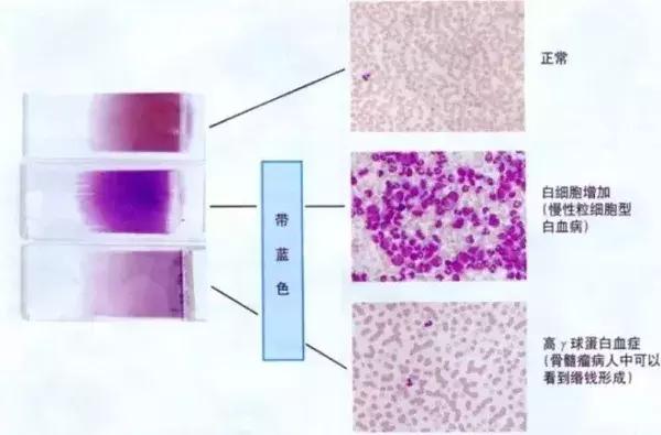 外周血细胞涂片的正常值,外周血细胞分析多长时间出结果