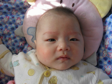 宝宝一急眉毛处就红怎么回事,宝宝眉毛发红是怎么回事