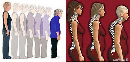 身体过早衰老还能活多久,提前衰老的四大征兆需要引起注意