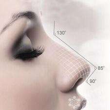 线雕隆鼻多少钱,什么是隆鼻