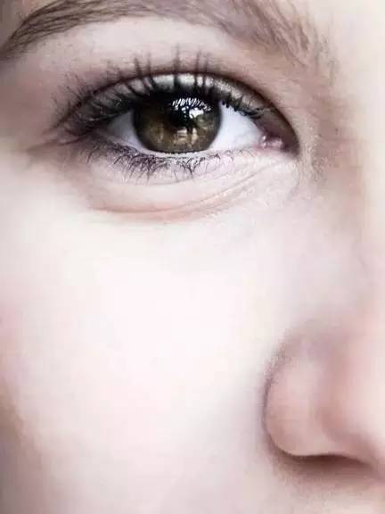 整形鼻子会留疤吗,胸部整形手术会留疤么