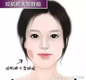 瘦脸针三次真的能定型吗,瘦脸针打三次就可以永久定型了吗