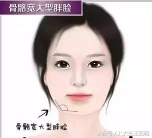 瘦脸针三次真的能定型吗,瘦脸针打三次就可以永久定型了吗