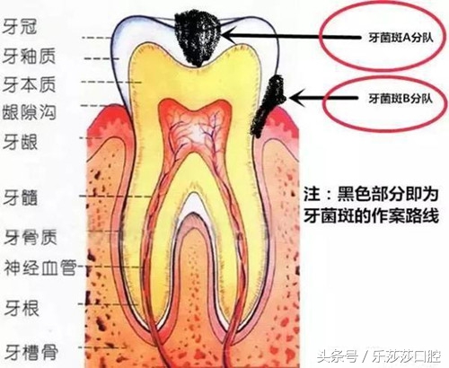 牙齿掉出一小块石头,牙齿内侧掉出一块石头怎么回事