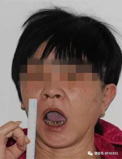 北京友谊医院颞下颌关节科,北京友谊医院手术单